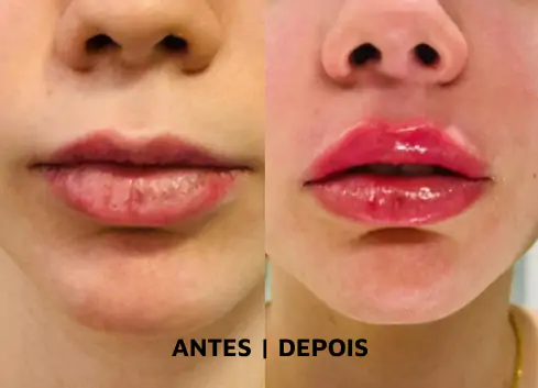 DEP-01