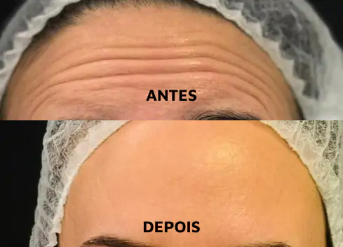 DEP-03