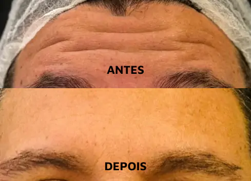 DEP-04